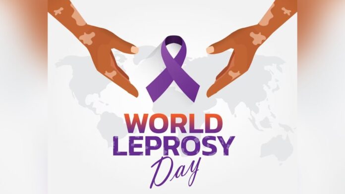 World Leprosy Day