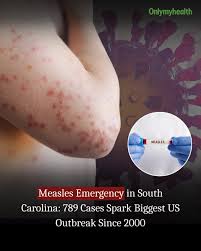 Measles