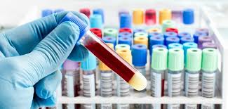 New blood test developed in Australia