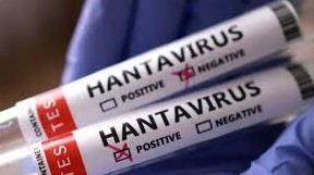Hanta virus