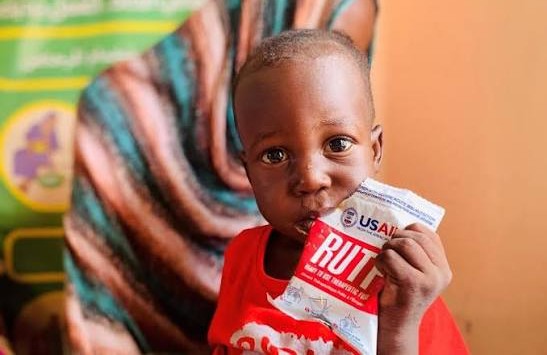 severe malnutrition