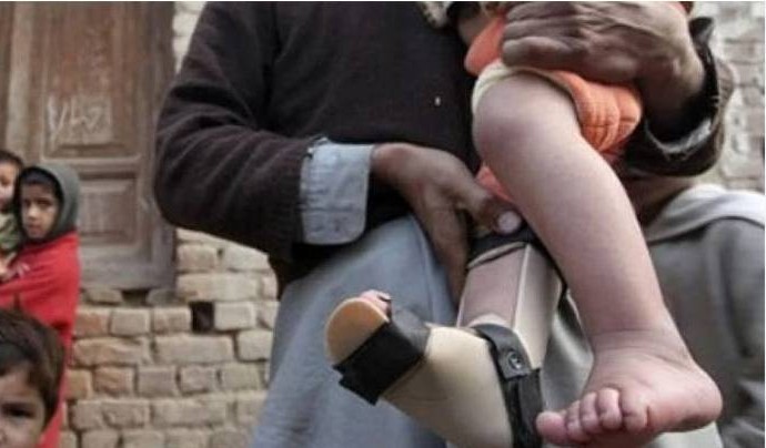 polio case