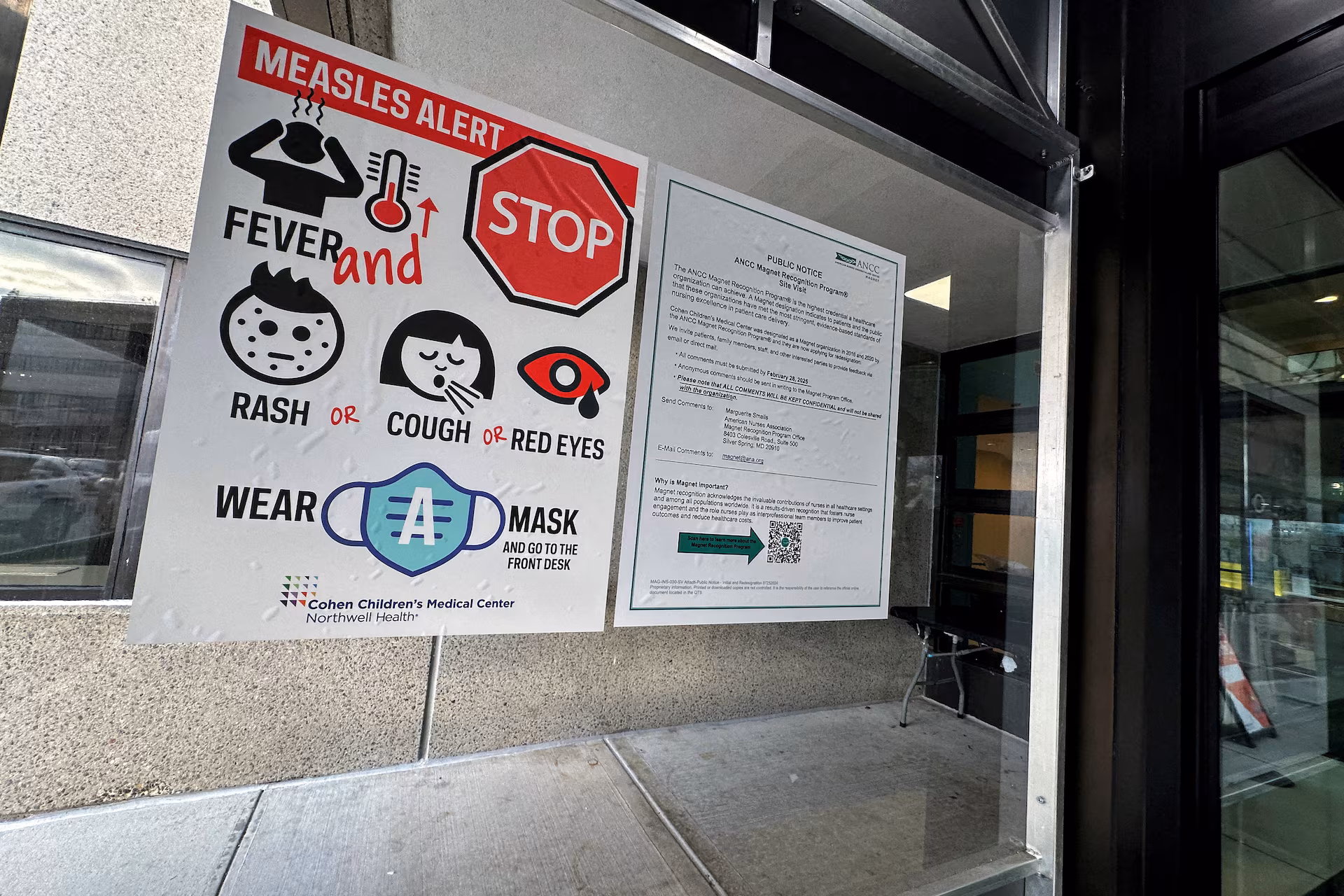 Measles