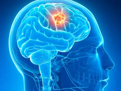 51