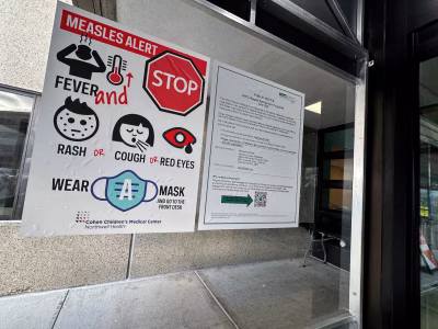 Measles
