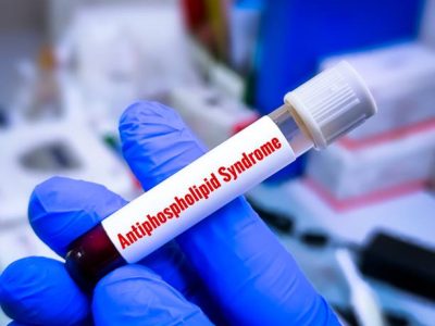 Blood sample tube for antiphospholipid syndrome (APS) test, diagnosis for autoimmune disease