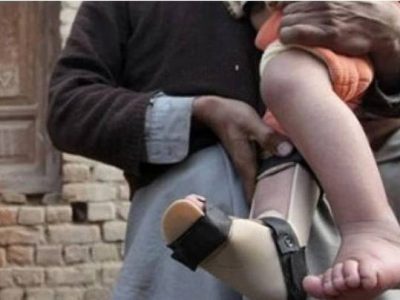 polio case